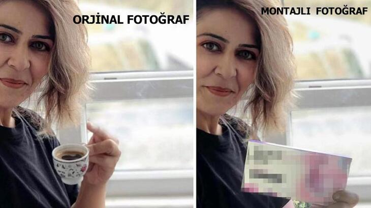 Tüp mide ameliyatıyla zayıfladı! Fotoğrafını ilaç firması kullandı