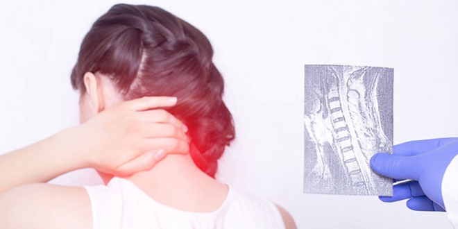 Kas ağrısı deyip geçmeyin