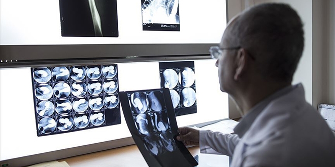 Meme kanserinde 'mamografi' hayat kurtarıyor