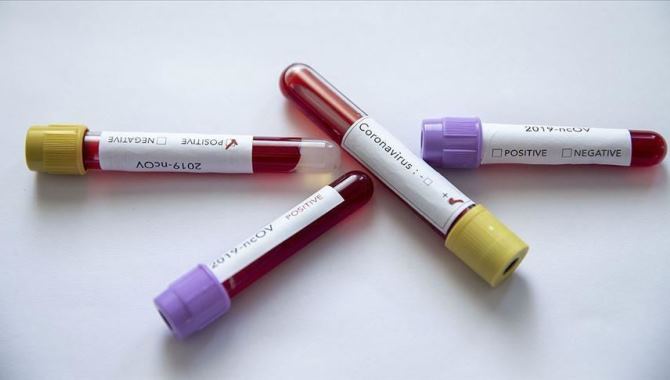 Mısır'da Kovid-19 kaynaklı ilk ölüm