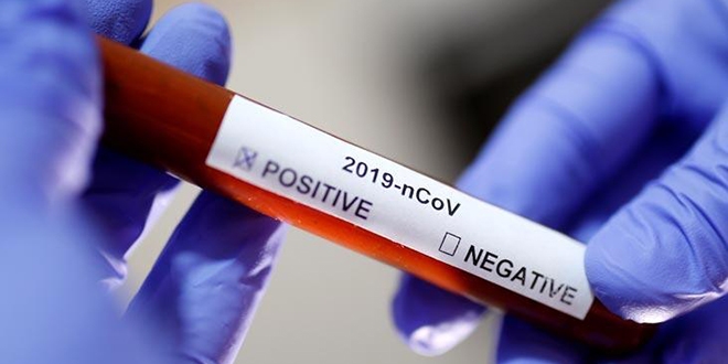 Avustralya'da koronavirüsten ilk can kaybı
