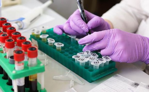 Bilim Kurulu Üyesi: Antikor testleri 81 ilde pazartesi başlayacak