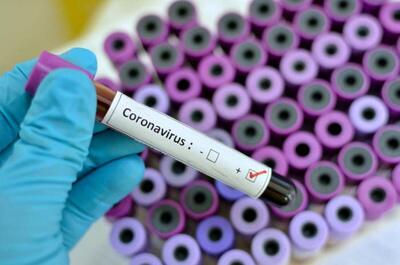 'Öpücük tedavisiyle' Kovid-19 hastalarını iyileştirdiğini iddia eden kişi, koronavirüs nedeniyle öldü