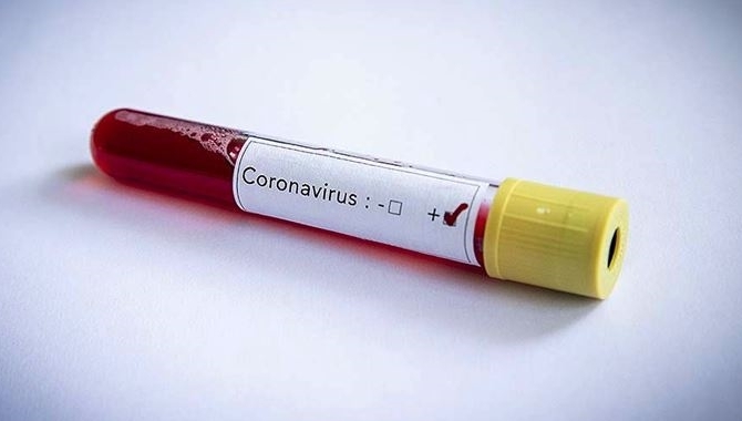 Kovid-19 tedavisinde "hidroksiklorokin" ilacı kullanılmayacak