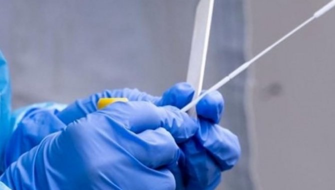 Bilim insanları Kovid-19’un kökenine ilişkin araştırmaların DSÖ bünyesinde yürütülmemesi gerektiğini düşünüyor