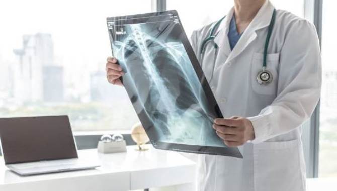 COVID-19 için çekilen tomografiler akciğer kanserlerini erken evrede yakaladı