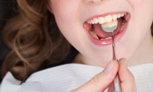 Dişler için faydalı 4 besin