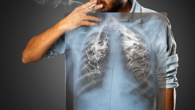 Akciğer Kanseri Cerrahi Tedavisi