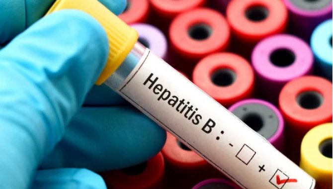 Nijerya'da hepatit virüsü taşıyan 18 milyon insan bulunuyor