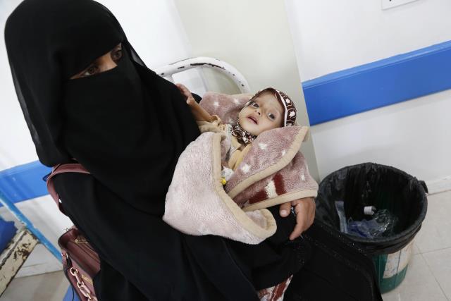 Yemen'de kol gezen kıtlık çocukların hayatını tehdit ediyor
