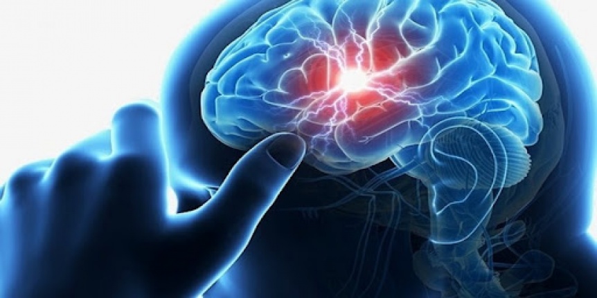 Dünya genelinde her 1 dakikada 1 kişi inme geçiriyor