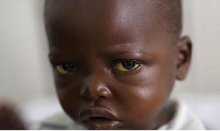 Gana'da 8 çocuk sarı hummadan hayatını kaybetti