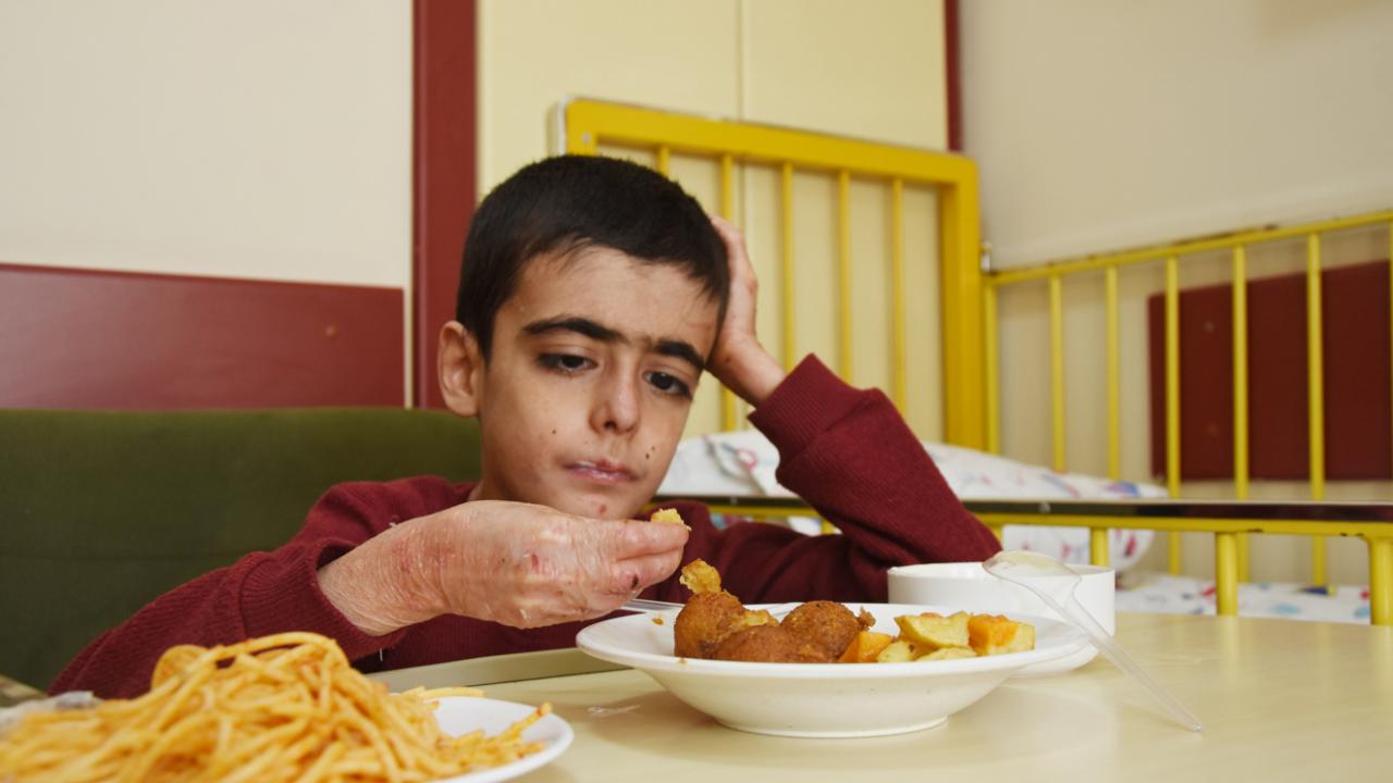 Kütahya'da tedavi edilen 6 kelebek hastası ilk kez katı gıdayla beslendi