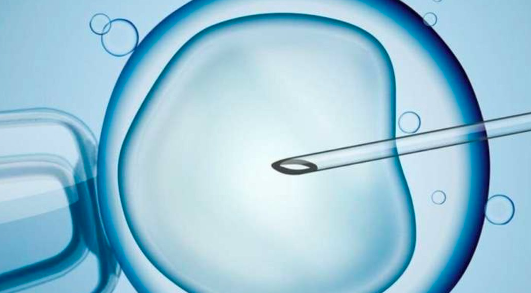 Sperm Donasyonu Nedir Dinen Caiz Mi