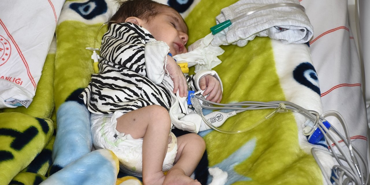 Kalpten çıkan iki ana damarı ters olarak doğan bebek, 53 günlük yaşam savaşını kazandı