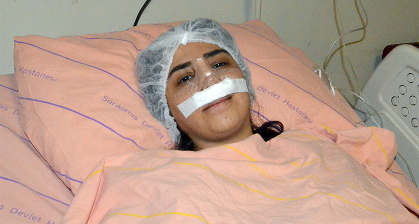 Kaburgasından alınan kıkırdakla burnu düzeltilen kadın sağlığına kavuştu