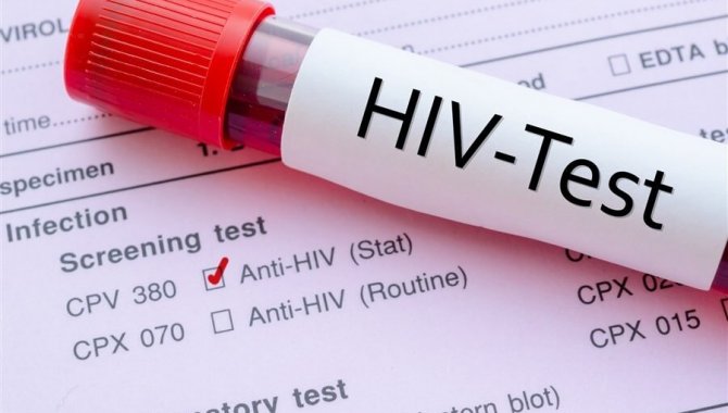 "Herkes hayatında bir kez HIV testi yaptırsın" önerisi