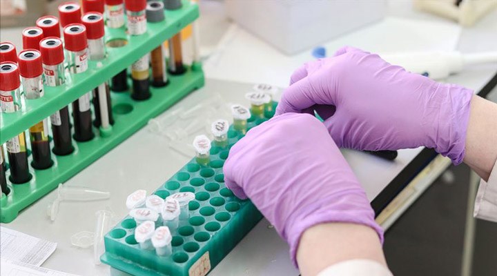 Kocaeli'de evlilik öncesi SMA testi uygulamasına başlandı