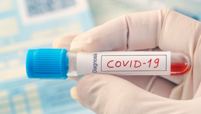 Enfeksiyon hastalıkları uzmanından grip ve Kovid-19'a karşı tedbir çağrısı: