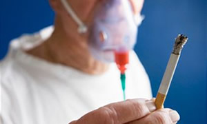 Sigara böbrek kanserine neden oluyor