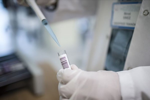 Türkiye'de 485 cüzzam hastası bulunuyor