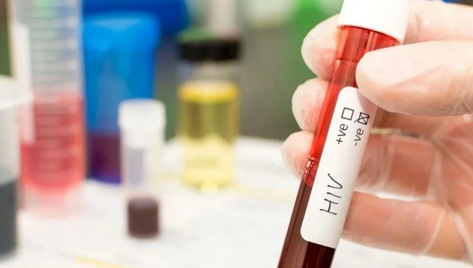 Güney Afrika ve Brezilya'da HIV enfeksiyonu uzun süre etkili aşılarla önlenecek