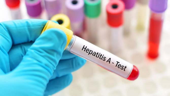 Dünyada gizemli hepatit vakaları 228'e yükseldi