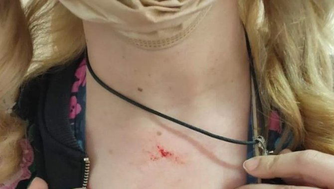 Kayseri'de bir kişi, aşı yaptırmak için geldiği aile sağlık merkezinde ebeyi darbetti