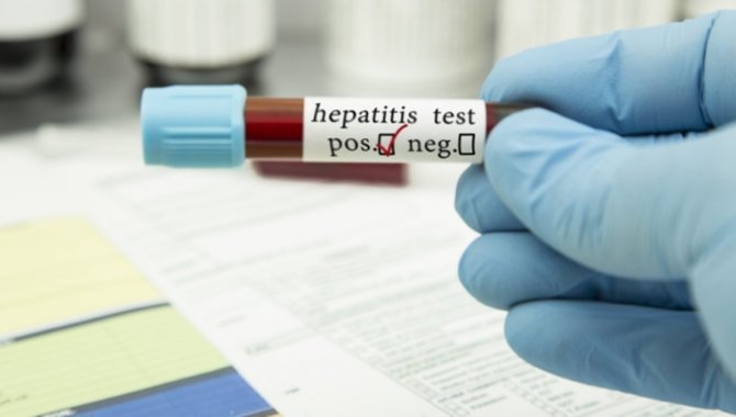DSÖ: Gizemli hepatit vakaları 700'e, can kayıpları 10'a yükseldi