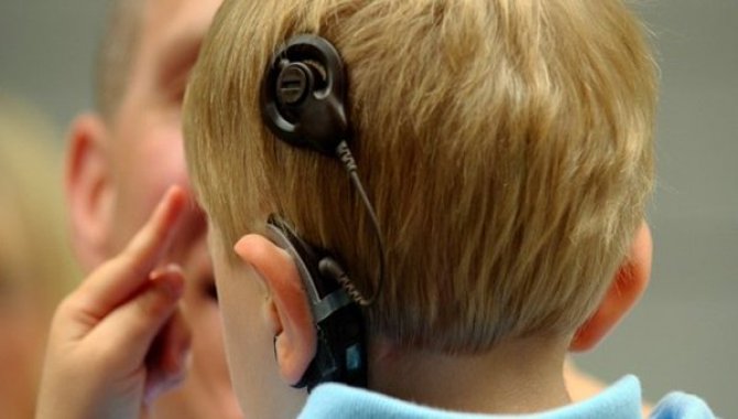 İşitme kaybı bulunan çocukların sessiz dünyaları biyonik kulakla değişti