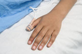 'Kopan parmak' için hastanelere ceza