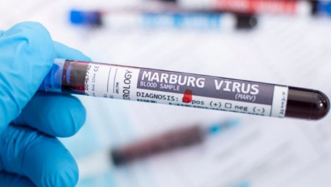 Gana'daki Marburg humması salgını sona erdi