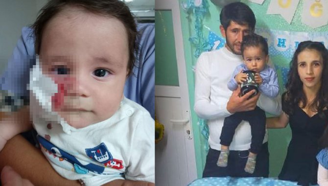 Muğla'da yanağını at ısıran bebek ameliyata alındı