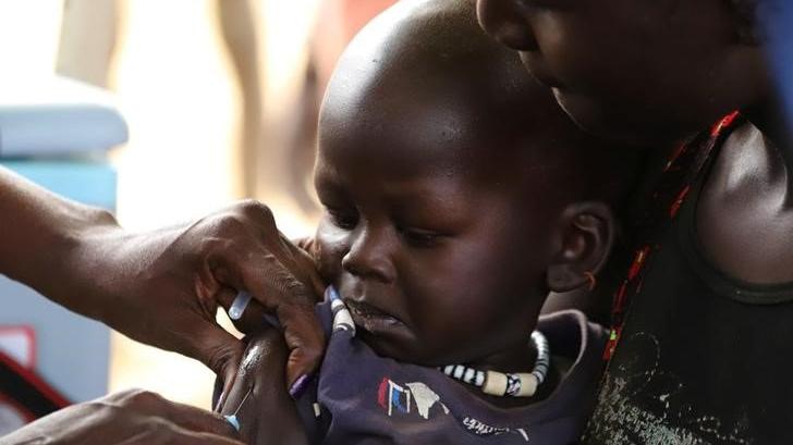 Güney Afrika'da "bölgesel kızamık" salgını yaşanıyor