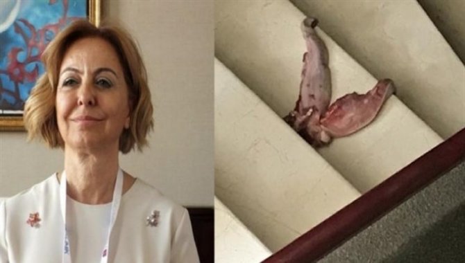 "Dana dili" ile doktoru tehdit eden şüpheliye dava