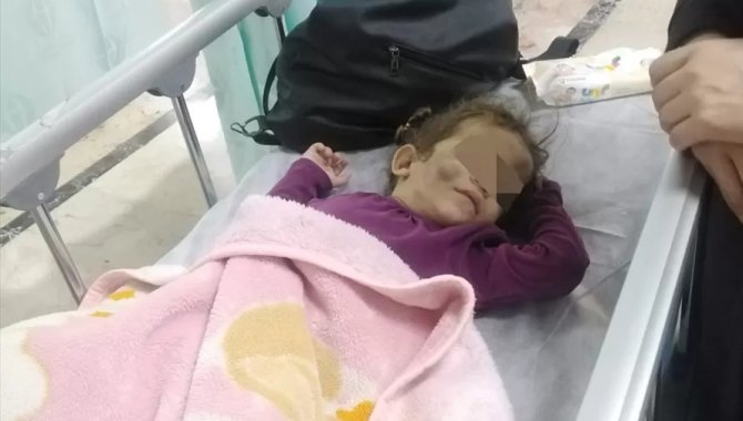 GÜNCELLEME - Gaziantep'te annesi tarafından darbedilen çocuk tedavi altına alındı