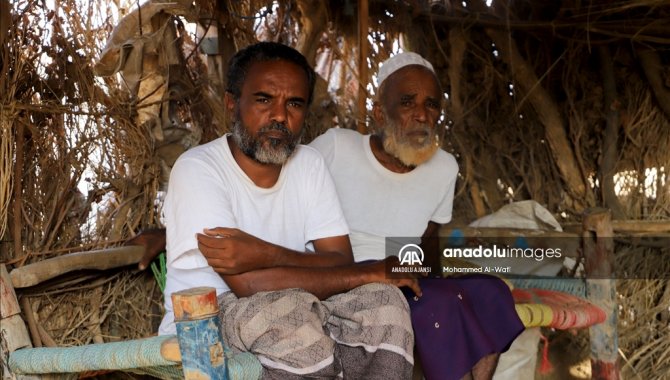 Savaş ve ekonomik krizle boğuşan Yemen'de yüzlerce kişi gözlerini kaybetme tehdidi altında