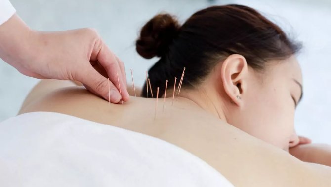 Medical Point, akupunktur yöntemiyle sigarayı bırakma imkanı sunuyor