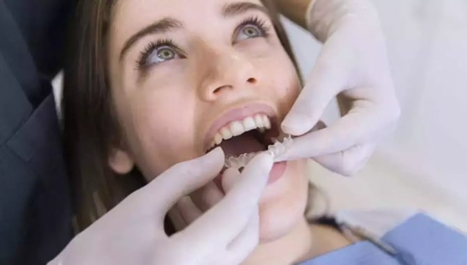 Şeffaf plak tedavisine başlamadan önce dişlerin nasıl olacağı görülebiliyor