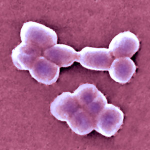 Bir bakterinin direnci arttı, hastaneler dikkat