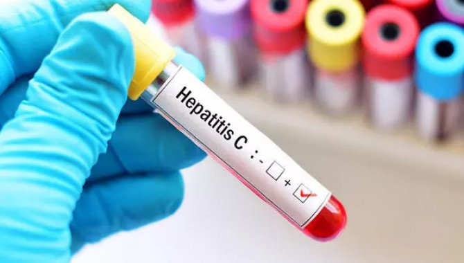 Dünyada 320 milyon kişinin hepatit B ve C hastası olduğu tahmin ediliyor