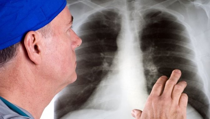 INVAMED'den "Dünya Akciğer Kanseri Farkındalık Günü" değerlendirmesi