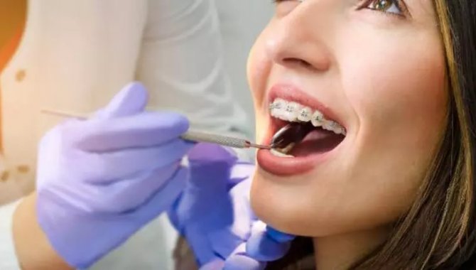 Ortodontik Sorunlar Öz Güven Problemlerine Yol Açabiliyor