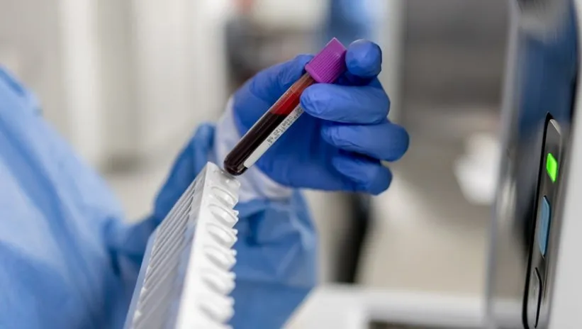 Türk ve Amerikan Hematoloji dernekleri hematolojide güncel gelişmeleri İstanbul'da ele aldı