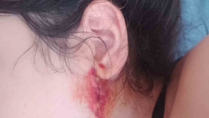 Ailesi Kızlarının Hastalığına Çare Arıyor