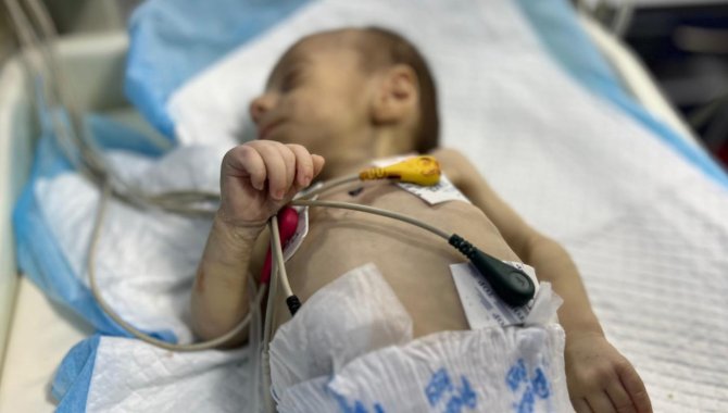 Gazze'de bir bebek yetersiz beslenme ve tedavi eksikliği nedeniyle hayatını kaybetti