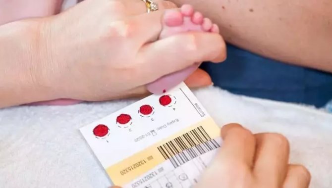 Kars Barosu, Kars Aile Mahkemesinin "topuk kanı" kararına itiraz edecek