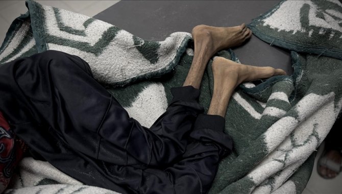 Gazze'de son 24 saatte 4'ü çocuk 15 Filistinli daha açlıktan hayatını kaybetti