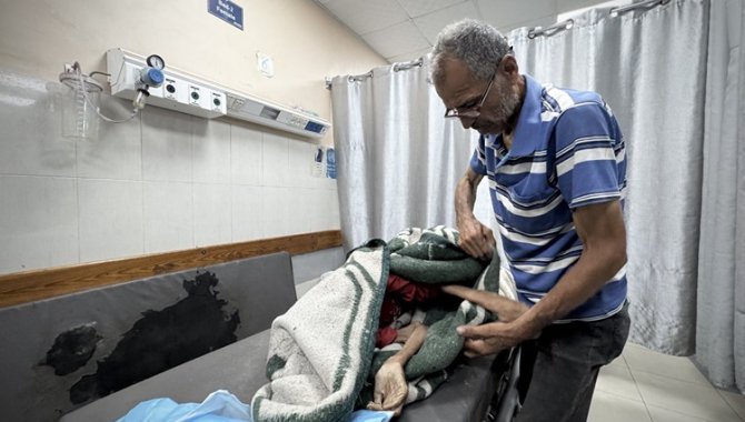 Gazze'de özel gereksinimli bir kadın açlık ve yetersiz beslenme sonucu hayatını kaybetti