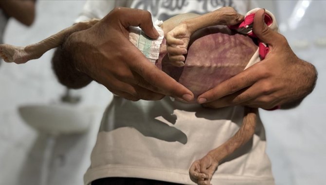 İsrail'in açlık ve kıtlığı dayattığı Gazze Şeridi'nde açlıktan ölenlerin sayısı 127'ye yükseldi